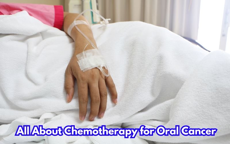 Chemotherapy For Oral Cancer