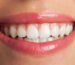दांतों को तुरंत सफेद कैसे करें