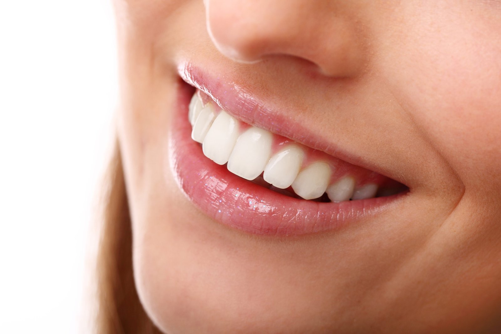 Best Teeth Whitening Kits for Fast, At-Home Results