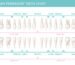 Tooth Chart